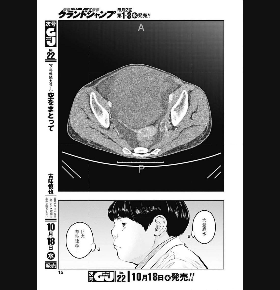 ラジエーションハウス 漫画 - raw - 第126話 - https://jpgg.ffgg.to/JPGG/04100025/ws0wyibpvir.jpg