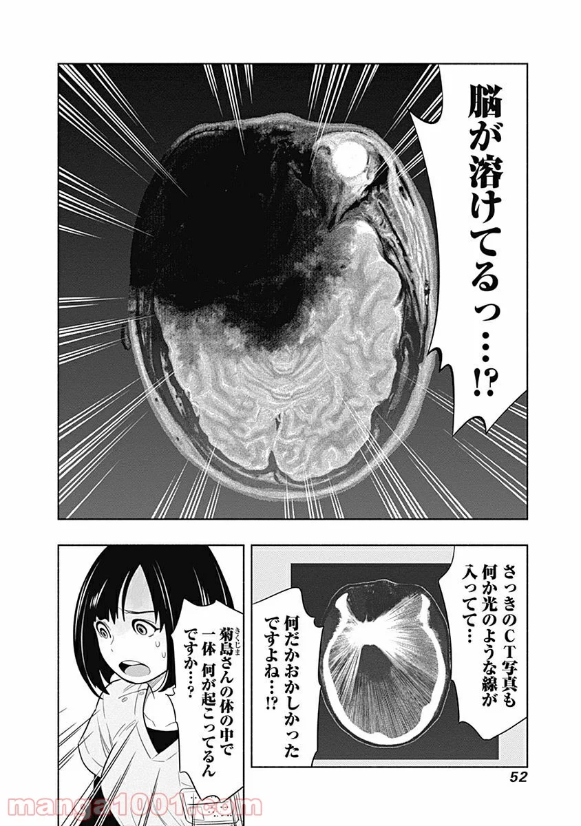 ラジエーションハウス 漫画 - raw - 第1話 - https://jpgg.ffgg.to/JPGG/04100050/hw0qppmq1mm.jpg